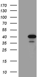 M-PST / STM Antibody - HEK293T cells were transfected with the pCMV6-ENTRY control. (Left lane) or pCMV6-ENTRY SULT1A3. (Right lane) cDNA for 48 hrs and lysed. Equivalent amounts of cell lysates. (5 ug per lane) were separated by SDS-PAGE and immunoblotted with anti-SULT1A3. (1:2000)