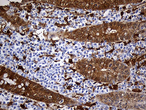 M-PST / STM Antibody - Immunohistochemical staining of paraffin-embedded Human testicle tissue within the normal limits using anti-SULT1A3 mouse monoclonal antibody. (Heat-induced epitope retrieval by 1mM EDTA in 10mM Tris buffer. (pH8.5) at 120°C for 3 min. (1:500)