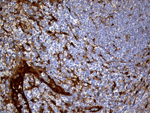 M-PST / STM Antibody - Immunohistochemical staining of paraffin-embedded Human tonsil within the normal limits using anti-SULT1A3 mouse monoclonal antibody. (Heat-induced epitope retrieval by 1mM EDTA in 10mM Tris buffer. (pH8.5) at 120°C for 3 min. (1:500)