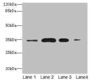 M-PST / STM Antibody - Western blot All Lanes: Sulfotransferase 1A3/1A4 antibody at 20ug/ml Lane 1: A549 whole cell lysate Lane 2: Colo320 whole cell lysate Lane 3: Mouse brain tissue Lane 4: Mouse kidney tissue Secondary Goat polyclonal to Rabbit IgG at 1/10000 dilution Predicted band size: 35,23 kDa Observed band size: 34 kDa