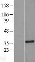 M-PST / STM Protein - Western validation with an anti-DDK antibody * L: Control HEK293 lysate R: Over-expression lysate