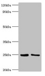 M. tuberculosis MPT64 Antibody - Western blot All lanes: Immunogenic protein MPT64 antibody at 2µg/ml Lane 1: Recombinant Immunogenic protein MPT64 protein 10 µg Lane 2: Recombinant Immunogenic protein MPT64 protein 1 µg Secondary Goat polyclonal to rabbit IgG at 1/10000 dilution Predicted band size: 25 kDa Observed band size: 25 kDa