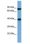 M1AP Antibody - M1AP antibody Western Blot of Jurkat. Antibody dilution: 1 ug/ml.  This image was taken for the unconjugated form of this product. Other forms have not been tested.