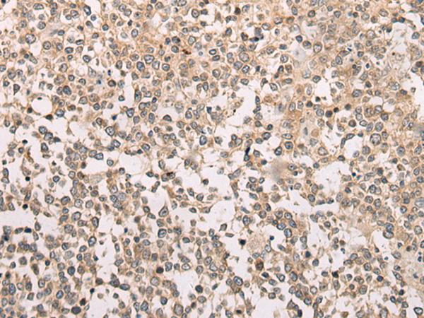 M1AP Antibody - Immunohistochemistry of paraffin-embedded Human tonsil tissue  using M1AP Polyclonal Antibody at dilution of 1:80(×200)