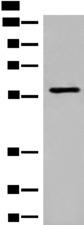 M1AP Antibody - Western blot analysis of Jurkat cell lysate  using M1AP Polyclonal Antibody at dilution of 1:600
