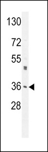 M6PR Antibody - M6PR Antibody western blot of A549 cell line lysates (35 ug/lane). The M6PR antibody detected the M6PR protein (arrow).