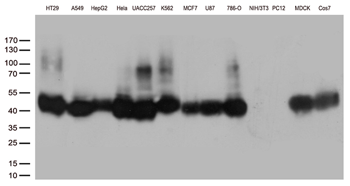 M6PR Antibody - Western blot analysis of extracts. (35ug) from 13 different cell lines by using anti-M6PR monoclonal antibody. (1:500)