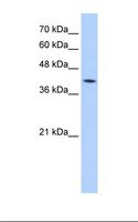M6PR Antibody - Jurkat cell lysate. Antibody concentration: 5.0 ug/ml. Gel concentration: 12%.  This image was taken for the unconjugated form of this product. Other forms have not been tested.