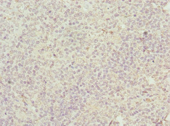 M6PR Antibody - Immunohistochemistry of paraffin-embedded human tonsil tissue using M6PR Antibody at dilution of 1:100