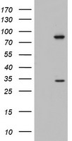 MAATS1 Antibody - HEK293T cells were transfected with the pCMV6-ENTRY control (Left lane) or pCMV6-ENTRY C3orf15 (Right lane) cDNA for 48 hrs and lysed. Equivalent amounts of cell lysates (5 ug per lane) were separated by SDS-PAGE and immunoblotted with anti-C3orf15.