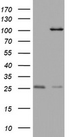 MAATS1 Antibody - HEK293T cells were transfected with the pCMV6-ENTRY control (Left lane) or pCMV6-ENTRY C3orf15 (Right lane) cDNA for 48 hrs and lysed. Equivalent amounts of cell lysates (5 ug per lane) were separated by SDS-PAGE and immunoblotted with anti-C3orf15.