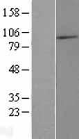 MAATS1 Protein - Western validation with an anti-DDK antibody * L: Control HEK293 lysate R: Over-expression lysate