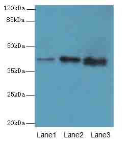 MAB21L1 Antibody - Western blot. All lanes: MAB21L1 antibody at 6 ug/ml. Lane 1: A375 whole cell lysate. Lane 2: CEM whole cell lysate. Lane 3: Mouse brain tissue. Secondary Goat polyclonal to Rabbit IgG at 1:10000 dilution. Predicted band size: 41 kDa. Observed band size: 41 kDa.