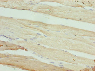 MAB21L1 Antibody - Immunohistochemistry of paraffin-embedded human skeletal muscle tissue using MAB21L1 Antibody at dilution of 1:100