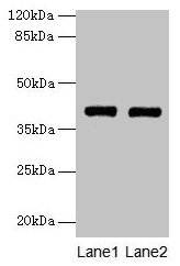 MAB21L1 Antibody - Western blot All lanes: MAB21L1 antibody at 6µg/ml Lane 1: A375 whole cell lysate Lane 2: CEM whole cell lysate Lane 3: Mouse brain tissue Secondary Goat polyclonal to rabbit IgG at 1/10000 dilution Predicted band size: 41 kDa Observed band size: 41 kDa