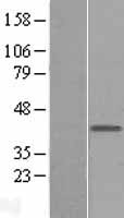 MAB21L1 Protein - Western validation with an anti-DDK antibody * L: Control HEK293 lysate R: Over-expression lysate