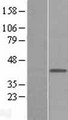 MAB21L1 Protein - Western validation with an anti-DDK antibody * L: Control HEK293 lysate R: Over-expression lysate