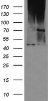 MAB21L3 / C1orf161 Antibody - HEK293T cells were transfected with the pCMV6-ENTRY control (Left lane) or pCMV6-ENTRY C1orf161 (Right lane) cDNA for 48 hrs and lysed. Equivalent amounts of cell lysates (5 ug per lane) were separated by SDS-PAGE and immunoblotted with anti-C1orf161.