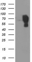 MAC-2-BP / LGALS3BP Antibody - HEK293T cells were transfected with the pCMV6-ENTRY control (Left lane) or pCMV6-ENTRY LGALS3BP (Right lane) cDNA for 48 hrs and lysed. Equivalent amounts of cell lysates (5 ug per lane) were separated by SDS-PAGE and immunoblotted with anti-LGALS3BP.