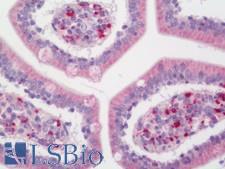 MAC-2-BP / LGALS3BP Antibody - Human Small Intestine: Formalin-Fixed, Paraffin-Embedded (FFPE)