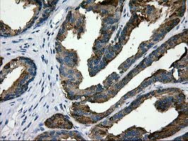 MAC-2-BP / LGALS3BP Antibody - IHC of paraffin-embedded Human prostate tissue using anti-LGALS3BP mouse monoclonal antibody.