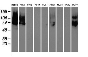 MAC-2-BP / LGALS3BP Antibody - Western blot of extracts (35 ug) from 9 different cell lines by using anti-LGALS3BP monoclonal antibody.