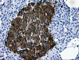MAC-2-BP / LGALS3BP Antibody - IHC of paraffin-embedded Human pancreas tissue using anti-LGALS3BP mouse monoclonal antibody.