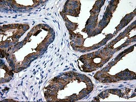 MAC-2-BP / LGALS3BP Antibody - IHC of paraffin-embedded Human prostate tissue using anti-LGALS3BP mouse monoclonal antibody.