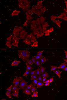 MAC-2-BP / LGALS3BP Antibody - Immunofluorescence analysis of A549 cells.