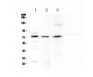 MAC-2-BP / LGALS3BP Antibody - Western blot analysis of LGALS3BP using anti-LGALS3BP antibody