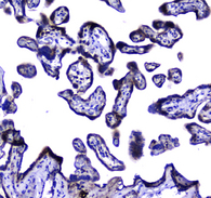 MAC-2-BP / LGALS3BP Antibody - IHC analysis of LGALS3BP using anti-LGALS3BP antibody. LGALS3BP was detected in paraffin-embedded section of human placenta tissue. Heat mediated antigen retrieval was performed in citrate buffer (pH6, epitope retrieval solution) for 20 mins. The tissue section was blocked with 10% goat serum. The tissue section was then incubated with 2µg/ml rabbit anti-LGALS3BP Antibody overnight at 4°C. Biotinylated goat anti-rabbit IgG was used as secondary antibody and incubated for 30 minutes at 37°C. The tissue section was developed using Strepavidin-Biotin-Complex (SABC) with DAB as the chromogen.