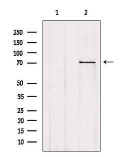 MAC-2-BP / LGALS3BP Antibody - Western blot analysis of extracts of 293 cells using LGALS3BP antibody. Lane 1 was treated with the blocking peptide.
