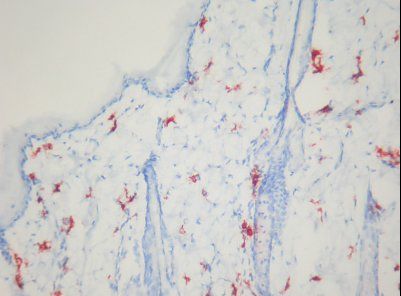 Macrophage Antibody - IHC of Macrophages antibody. Frozen section of rat skin.