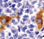 Macrophage Antibody - IHC of Macrophage on FFPE Liver tissue.