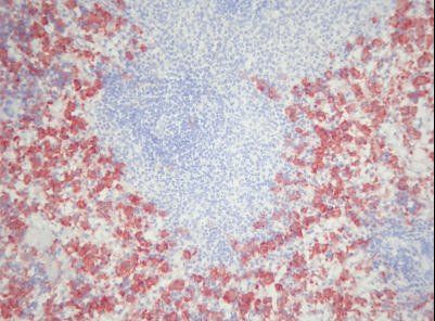 Macrophage Antibody - IHC of Macrophages antibody. Frozen section of rat spleen.