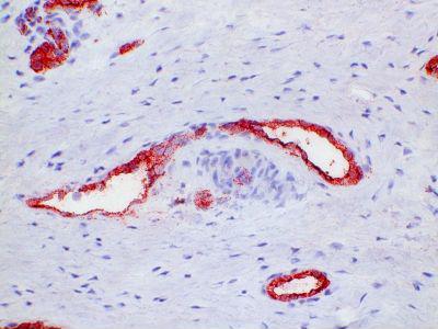 Macrophages, Neutrophils Antibody - Clone PM1 swine uterus , frozen section