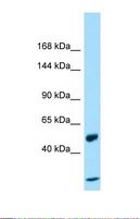 MACS / RIN2 Antibody - Western blot of Placenta. CCDC80 antibody dilution 1.0 ug/ml.  This image was taken for the unconjugated form of this product. Other forms have not been tested.