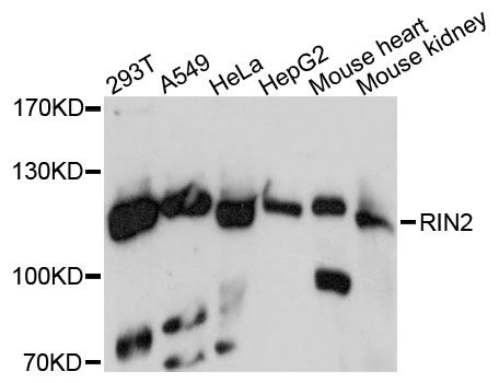 MACS / RIN2 Antibody - Western blot analysis of extracts of various cell lines, using RIN2 antibody at 1:3000 dilution. The secondary antibody used was an HRP Goat Anti-Rabbit IgG (H+L) at 1:10000 dilution. Lysates were loaded 25ug per lane and 3% nonfat dry milk in TBST was used for blocking. An ECL Kit was used for detection and the exposure time was 90s.
