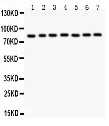 MAD1L1 / MAD1 Antibody - MAD1 antibody Western blot. All lanes: Anti MAD1 at 0.5 ug/ml. Lane 1: A549 Whole Cell Lysate at 40 ug. Lane 2: JURKAT Whole Cell Lysate at 40 ug. Lane 3: HELA Whole Cell Lysate at 40 ug. Lane 4: 293T Whole Cell Lysate at 40 ug. Lane 5: SHG Whole Cell Lysate at 40 ug. Lane 6: 22RV1 Whole Cell Lysate at 40 ug. Lane 7: PANC Whole Cell Lysate at 40 ug. Predicted band size: 83 kD. Observed band size: 83 kD.