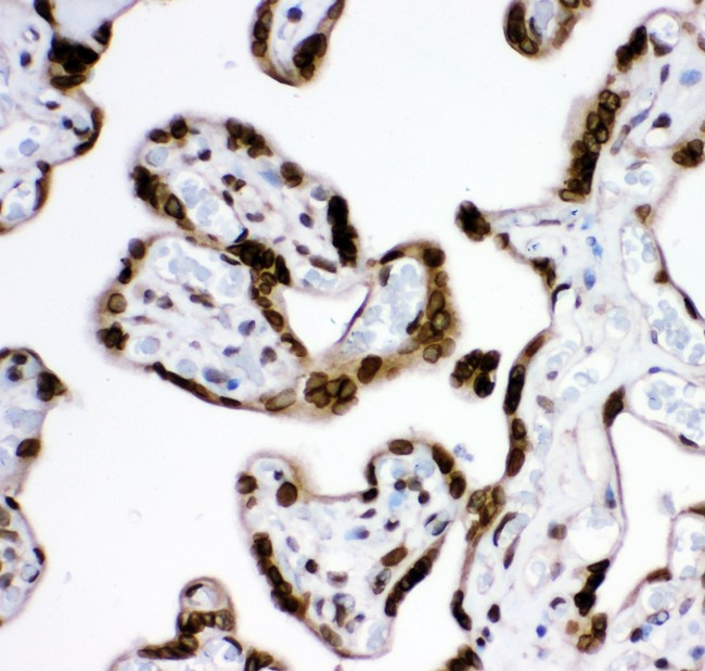 MAD1L1 / MAD1 Antibody - MAD1 antibody IHC-paraffin: Human Placenta Tissue.