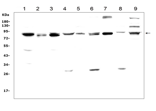 MAD1L1 / MAD1 Antibody - Western blot analysis of MAD1 using anti-MAD1 antibody. Electrophoresis was performed on a 5-20% SDS-PAGE gel at 70V (Stacking gel) / 90V (Resolving gel) for 2-3 hours. The sample well of each lane was loaded with 50ug of sample under reducing conditions. Lane 1: rat brain tissue lysates, Lane 2: rat kidney tissue lysates, Lane 3: rat lung tissue lysates, Lane 4: rat liver tissue lysates, Lane 5: mouse brain tissue lysates, Lane 6: mouse kidney tissue lysates, Lane 7: mouse lung tissue lysates, Lane 8: mouse liver tissue lysates, Lane 9: mouse NIH3T3 whole cell lysates. After Electrophoresis, proteins were transferred to a Nitrocellulose membrane at 150mA for 50-90 minutes. Blocked the membrane with 5% Non-fat Milk/ TBS for 1.5 hour at RT. The membrane was incubated with rabbit anti-MAD1 antigen affinity purified polyclonal antibody at 0.5 µg/mL overnight at 4°C, then washed with TBS-0.1% Tween 3 times with 5 minutes each and probed with a goat anti-rabbit IgG-HRP secondary antibody at a dilution of 1:10000 for 1.5 hour at RT. The signal is developed using an Enhanced Chemiluminescent detection (ECL) kit with Tanon 5200 system. A specific band was detected for MAD1 at approximately 83KD. The expected band size for MAD1 is at 83KD.