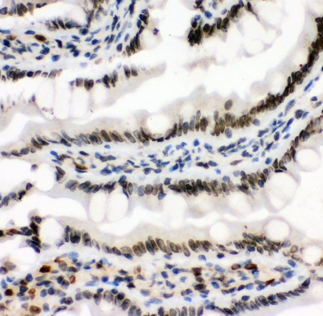 MAD1L1 / MAD1 Antibody - IHC analysis of MAD1 using anti-MAD1 antibody. MAD1 was detected in paraffin-embedded section of rat intestine tissues. Heat mediated antigen retrieval was performed in citrate buffer (pH6, epitope retrieval solution) for 20 mins. The tissue section was blocked with 10% goat serum. The tissue section was then incubated with 1µg/ml rabbit anti-MAD1 Antibody overnight at 4°C. Biotinylated goat anti-rabbit IgG was used as secondary antibody and incubated for 30 minutes at 37°C. The tissue section was developed using Strepavidin-Biotin-Complex (SABC) with DAB as the chromogen.