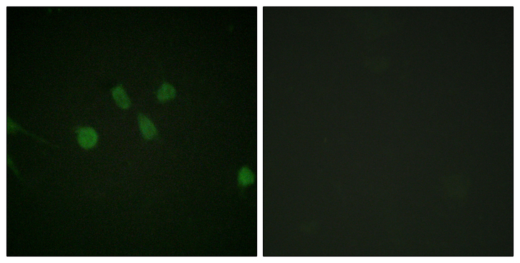 MAD1L1 / MAD1 Antibody - Immunofluorescence analysis of NIH/3T3 cells, using MAD1 Antibody. The picture on the right is blocked with the synthesized peptide.