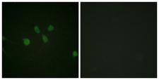 MAD1L1 / MAD1 Antibody - Immunofluorescence analysis of NIH/3T3 cells, using MAD1 Antibody. The picture on the right is blocked with the synthesized peptide.