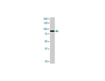 MAD1L1 / MAD1 Antibody - Anti- Mad1L1 monoclonal antibody. Western blot of Mad1L1 expression in A-431.