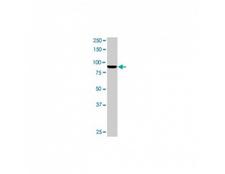 MAD1L1 / MAD1 Antibody - Anti- Mad1L1 monoclonal antibody. Western blot of Mad1L1 expression in A-431.