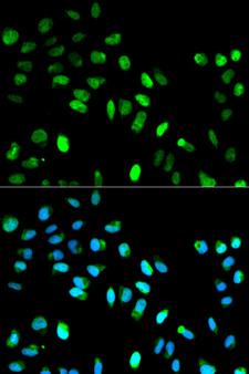 MAD1L1 / MAD1 Antibody - Immunofluorescence analysis of HeLa cells.