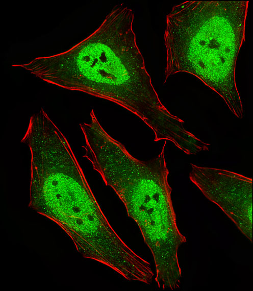 MAD2B / REV7 Antibody - Fluorescent image of HeLa cells stained with MAD2L2 Antibody. Antibody was diluted at 1:25 dilution. An Alexa Fluor 488-conjugated goat anti-rabbit lgG at 1:400 dilution was used as the secondary antibody (green). Cytoplasmic actin was counterstained with Alexa Fluor 555 conjugated with Phalloidin (red).