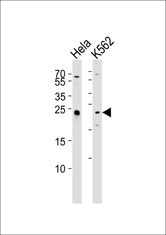 MAD2B / REV7 Antibody - Western blot of lysates from HeLa, K562 cell line (from left to right) with MAD2L2 Antibody. Antibody was diluted at 1:1000 at each lane. A goat anti-rabbit IgG H&L (HRP) at 1:5000 dilution was used as the secondary antibody. Lysates at 35 ug per lane.