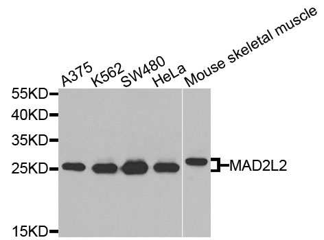 MAD2B / REV7 Antibody - Western blot analysis of extracts of various cells.